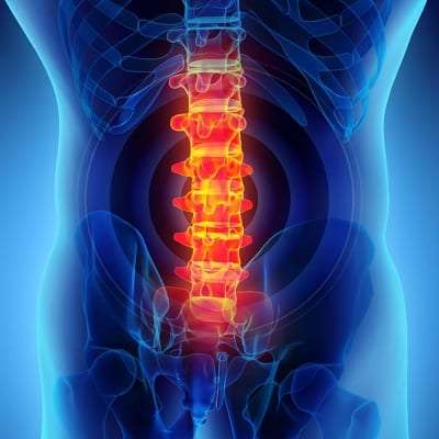 Pain Managment for Low Back Pain in Lakeland, Florida