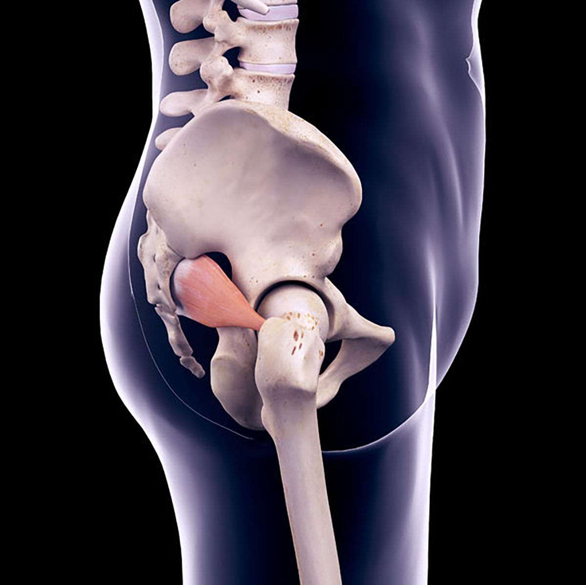 Pain Management for Piriformis Syndrome in Lakeland, Florida