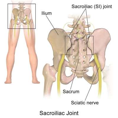 Pain Management for Sacroiliac Joint Pain in Lakeland, Florida