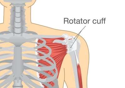 Pain Managment for Rotator Cuff Tear in Lakeland, Florida