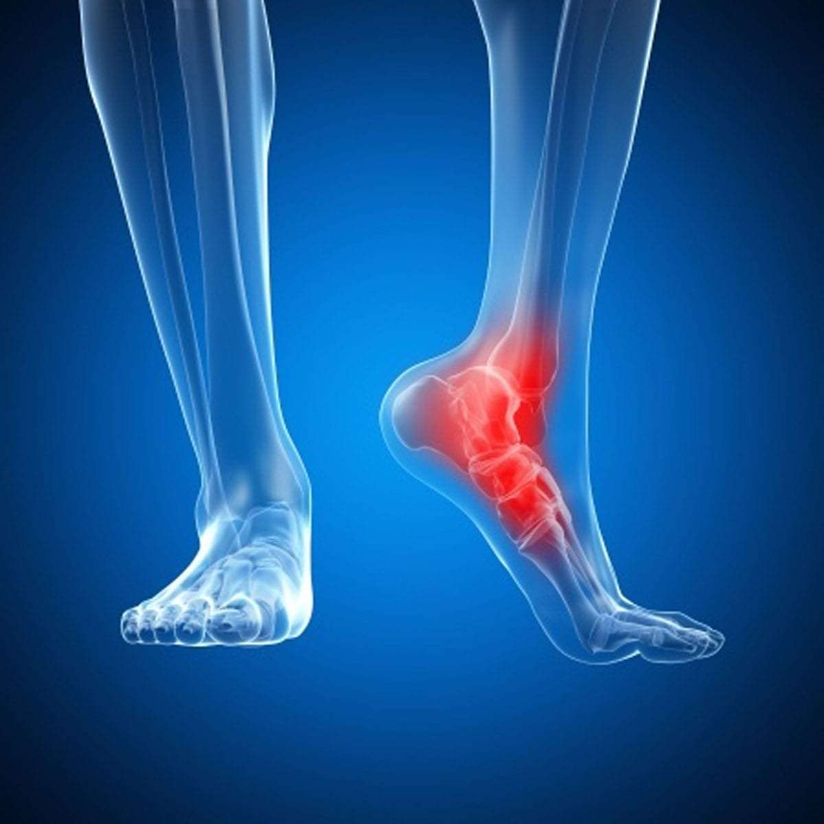 Ankle Pain - Symptoms and Treatment | Home Physio Group-totobed.com.vn