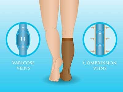 Pain Management Treatments with Compression Therapy in Lakeland, Florida