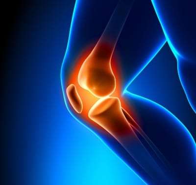 Knee pain treatment in Lakeland, Florida