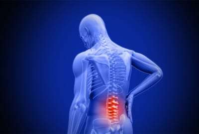 Caudal Steroid Injection for low back pain management in Lakeland, Florida