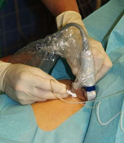 Pain management with a continuous catheter nerve block in Lakeland, Florida