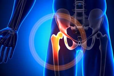Hip Injections in Lakeland, Florida